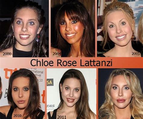 chloe lattanzi before|chloe rose olivia newton john.